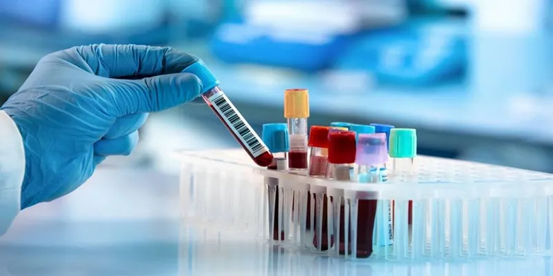 blood test samples 1200x750 59cd6b99366c6e716576ccd68351ed39 11zon