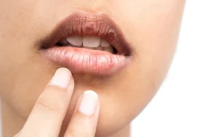 بهترین درمان خشکی لب چیست؟